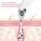Acne Pore Cleaner & Black Head Remover With Cleaning Tools
