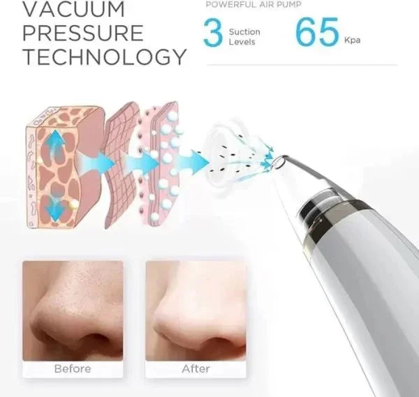 Acne Pore Cleaner & Black Head Remover With Cleaning Tools